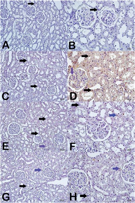 Light Microscope Image Of Testicular Tissue By Light Microscopy