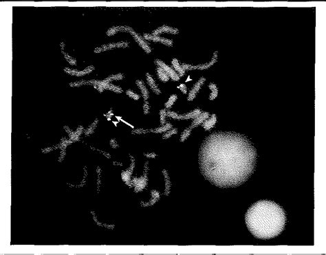 Figure 1 From Molecular Cytogenetics In Prenatal Diagnosis Semantic Scholar