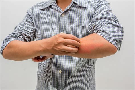 Itchy Arms And Legs In Winter Causes And Solutions Scary Symptoms