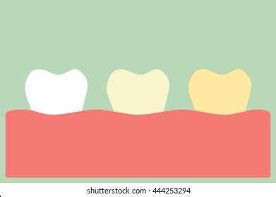 Dental Cartoon Vector Tooth Periodontal Disease Stock Vector Royalty