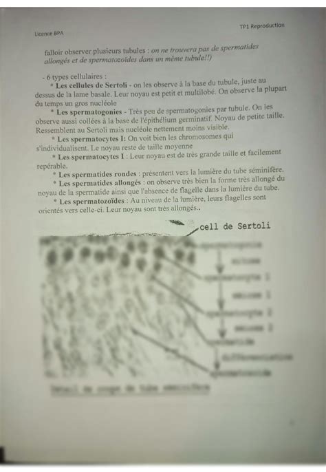 Solution Histologie Des Testicules Et Des V Sicules S Minales Studypool