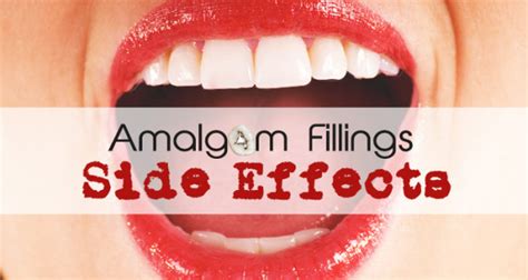 Amalgam Fillings Side Effects - Doctor Scott Health Blog