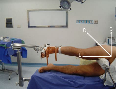 Patient Positioning For Hip Arthroscopy With The Patient On His Left