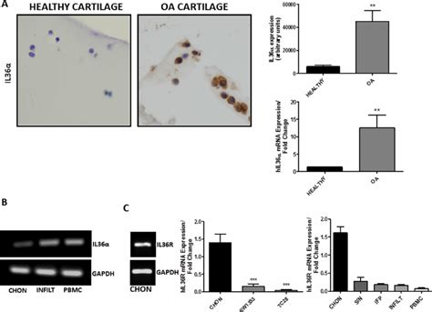 A Sections Of Knee Articular Cartilage From Healthy N 10 And Oa