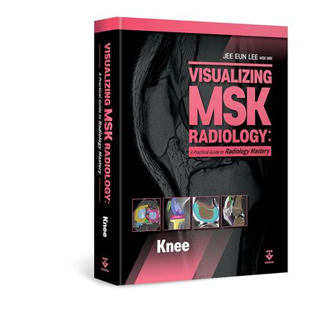 Visualizing MSK Radiology A Practical Guide To Radiology Mastery Jee