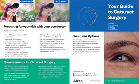 cataracts dr steve roberts professional corp eye doctor