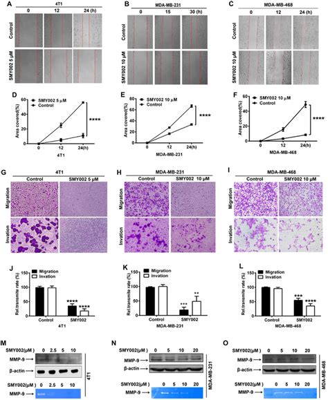 SMY002 Attenuates The Migration And Invasion Of TNBC Cells In Vitro