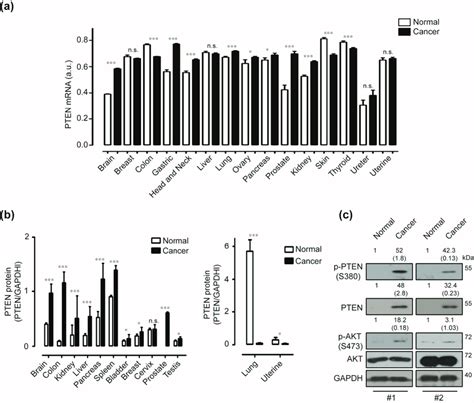 Expressions Of Phosphatase And Tensin Homolog Pten In Human