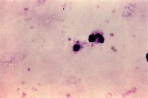 Imagen Gratis Micrografía Gruesa Película Madura Vivax Trophozoite Mancha Ampliación 1125x