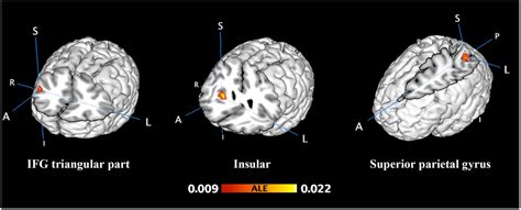 Inferior Frontal Gyrus Mri