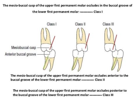 Classification Of Occlusion And Malocclusion Dr Nabil Al Zubair