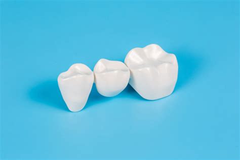 dental bridge procedure  step  step guide colorado precision