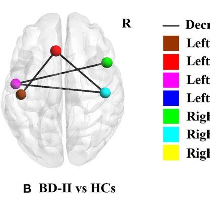 Significant Between Group Differences Of Cortical Structural