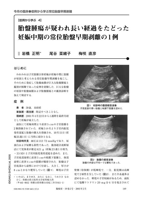 胎盤腫瘍が疑われ長い経過をたどった妊娠中期の常位胎盤早期剥離の1例 臨床婦人科産科 59巻2号 医書jp