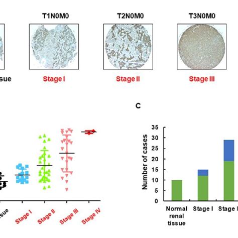 Expression Level Of Pyruvate Kinase M2 Pkm2 A Pkm2 Protein Was