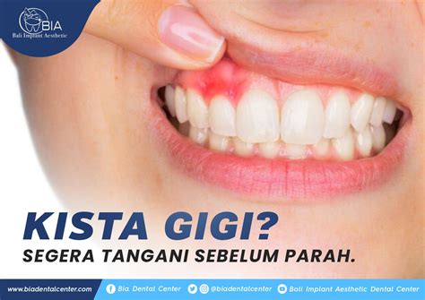 The Best Dental Clinic In Bali Bali Implant Aesthetic Bia Dental Center