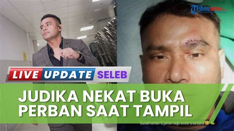 Alami Kecelakaan Saat Main Bola Hingga Kepala Dijahit Begini Kondisi