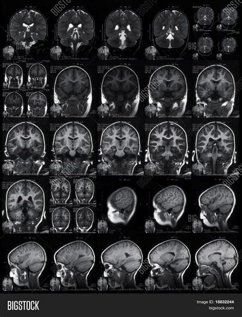 mri head scan image photo  trial bigstock