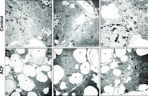 Transmission Electron Micrograph Of The Rat Liver In Control A C And Download Scientific