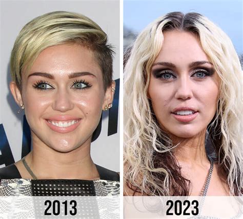 Miley Cyrus Plastic Surgery Myths And Facts Plasticsurgeryinsights