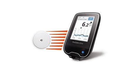 Freestyle libre flash glucose monitoring system - kopolhistory