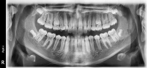 Badania Radiologiczne Rtg Ortodentico