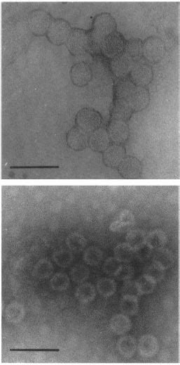 Electron Micrographs Of Vp1 Capsid Like Particles After Cscl Gradient