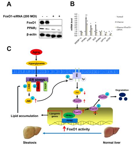 Effect Of High Glucose And Foxo Deletion On The Regulation Of Lipid