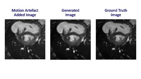 Github Jathurshan Cine Cardiac Mri Motion Artefact Reduction