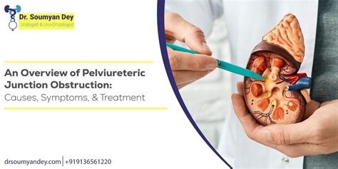 Pelviureteric Junction Obstruction Causes Symptoms And Treatment