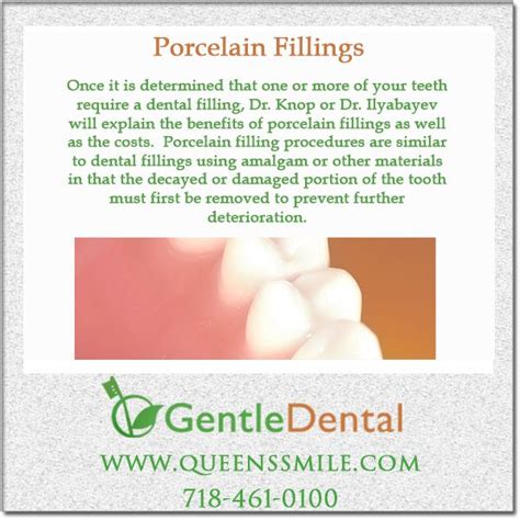 Porcelain Fillings at Bayside, Queens - Strong & Natural-Looking