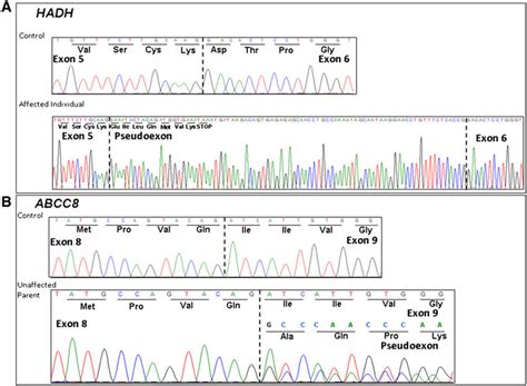 Electropherograms Showing CDNA Sequencing Analysis Of PCR Products