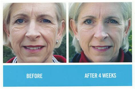 Rodan And Fields Redefine Regimen Anti Aging Beauty Secrets Rodan