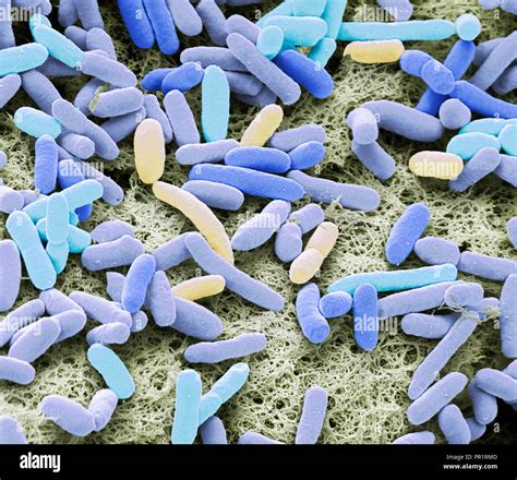 La Bact Rie E Coli Couleur De L Analyse Des Lectrons