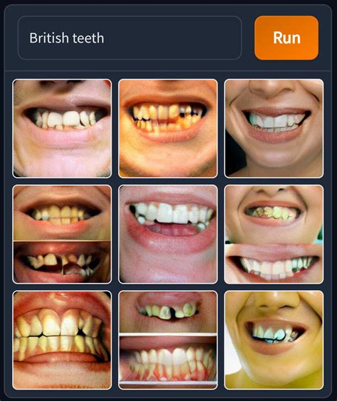 british teeth : weirddalle