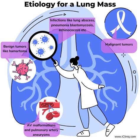 Lung Mass | Symptoms | Diagnosis | Treatment