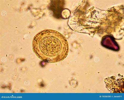 Hymenolepis diminuta stock image. Image of microscope - 70356285