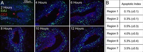 Analysis Of Apoptosis By Cleaved Caspase III CC3 Staining Apoptotic