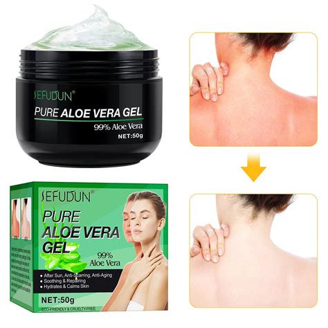 YiFudd Natural Aloe Vera Gel - Moisturizing Aloe Vera Gel, Face Skin ...