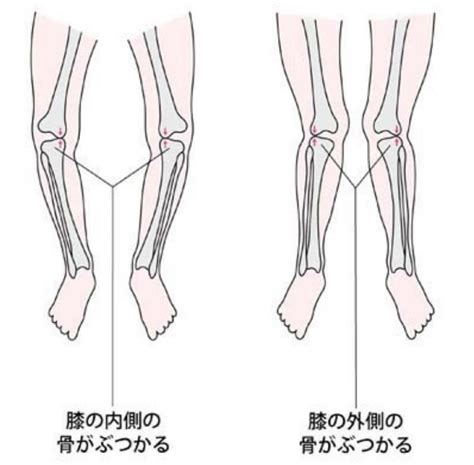 変形性膝関節症とは｜逗子葉山鎌倉の整体院andピラティススタジオ【reformer逗子院】