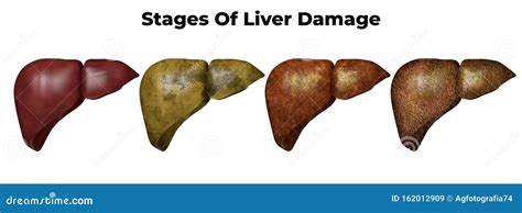 Symptoms Of Liver Disease Cartoon Vector | CartoonDealer.com #53960303