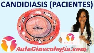 Candidiasis Vaginal Pacientes Causas Sintomas Tratamiento Gin Nbkomputer