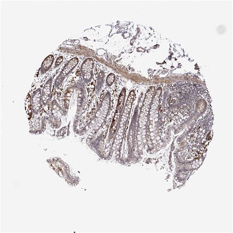 Tissue Expression Of Phgdh Staining In Colon The Human Protein Atlas