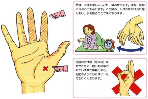 手根管症候群の症状と手術｜南川整形外科