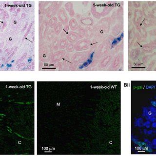 X-gal assay and b-galactosidase (b-gal) immunohistochemistry. A. X-gal ...