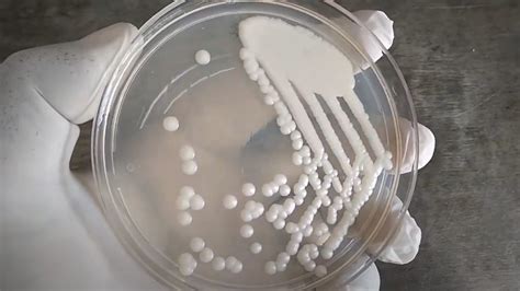 Cryptococcus neoformans: Introduction, Morphology, Pathogenecity, Lab