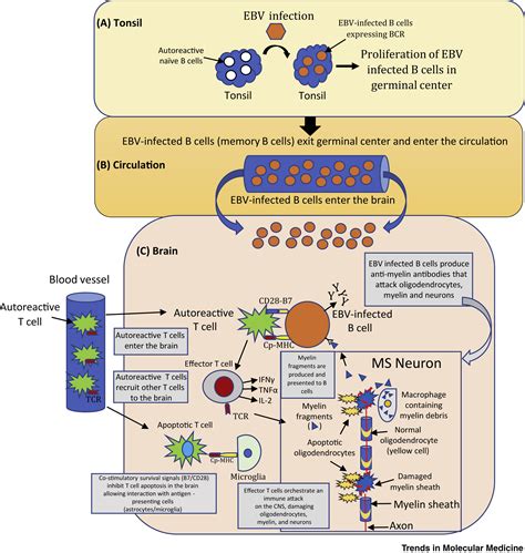 Epsteinbarr Virus In Multiple Sclerosis Theory And Emerging Immunotherapies Trends In