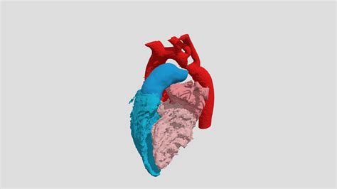 Coarctation Of Aorta S D Model By Nchs Cardiac Advanced