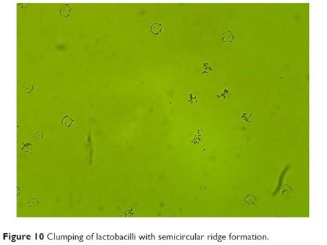 Vaginal Lactobacillus Biofilm Formation In Vivo Clinical Impl Ijwh