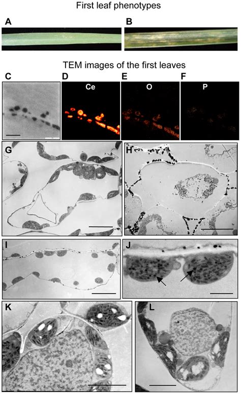 Transmission Electron Microscopic Tem Observations Of The